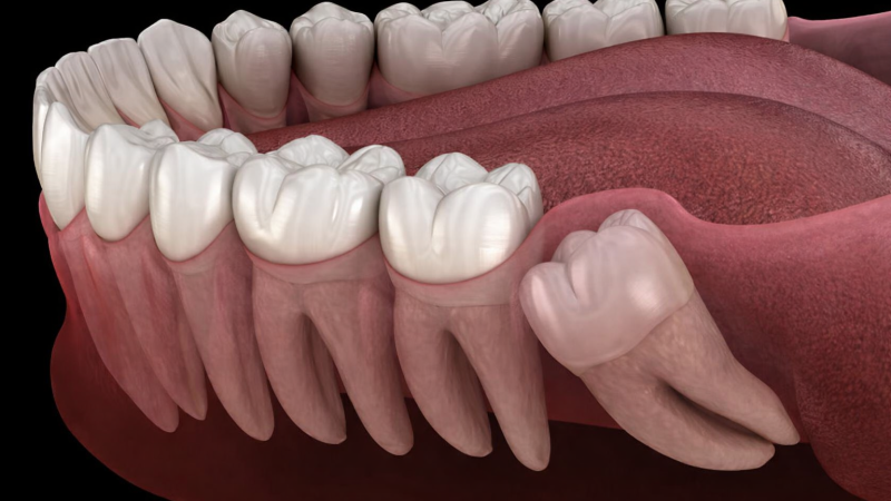 Ağız Diş ve Çene Cerrahisi