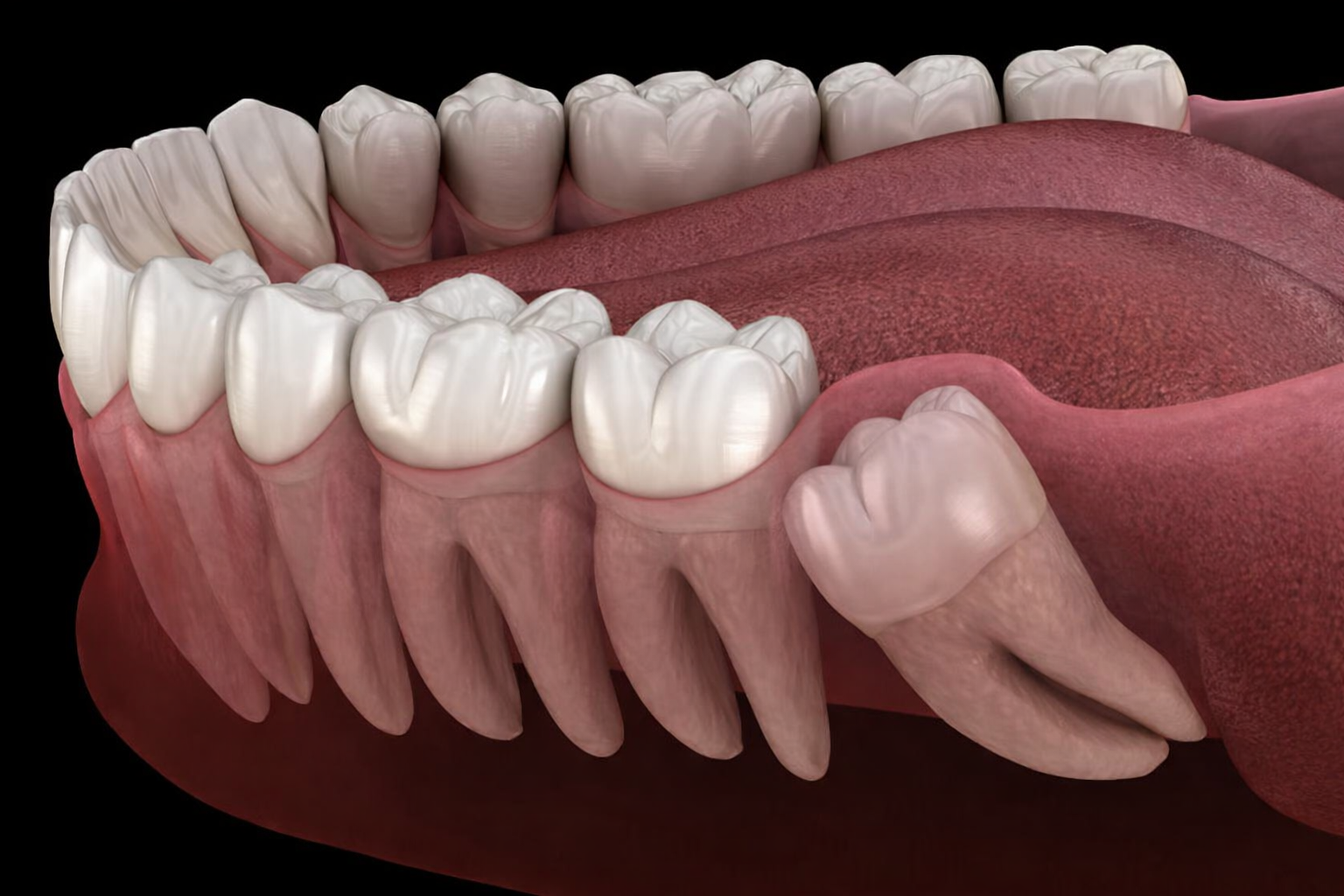 Ağız Diş ve Çene Cerrahisi