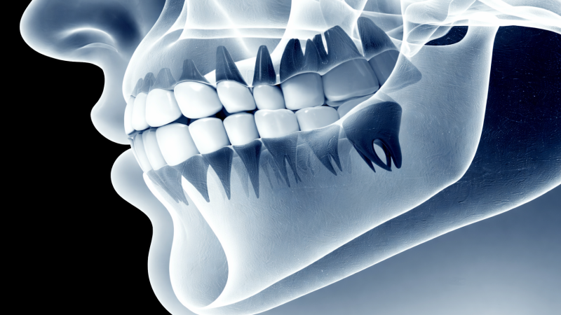 Röntgen ve Görüntüleme