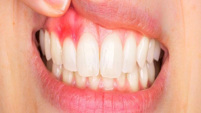 Periodontoloji